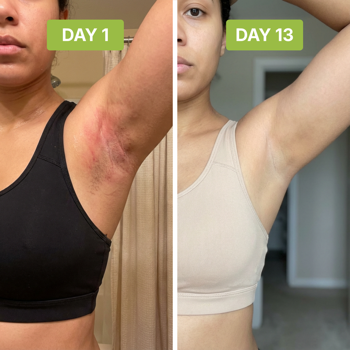 ClearSkin™ - Neutralizes Underarm Odor and Irritation.