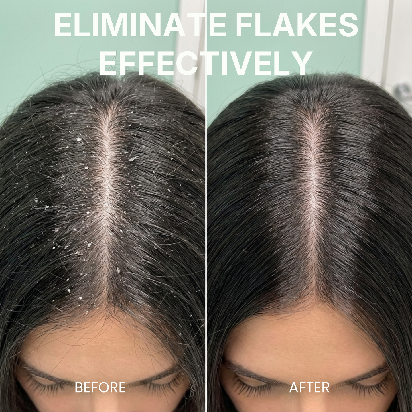 Pre-Shampoo Exfoliating for Dry, Flaky Scalp