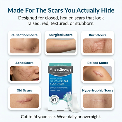 Silicone Scar Sheets - Scar Away Advanced