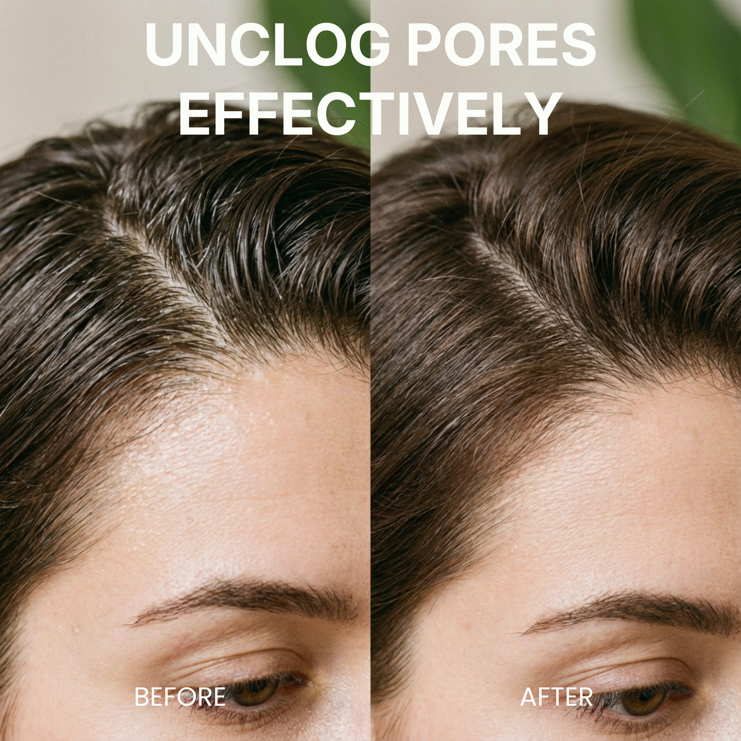 Pre-Shampoo Exfoliating for Dry, Flaky Scalp