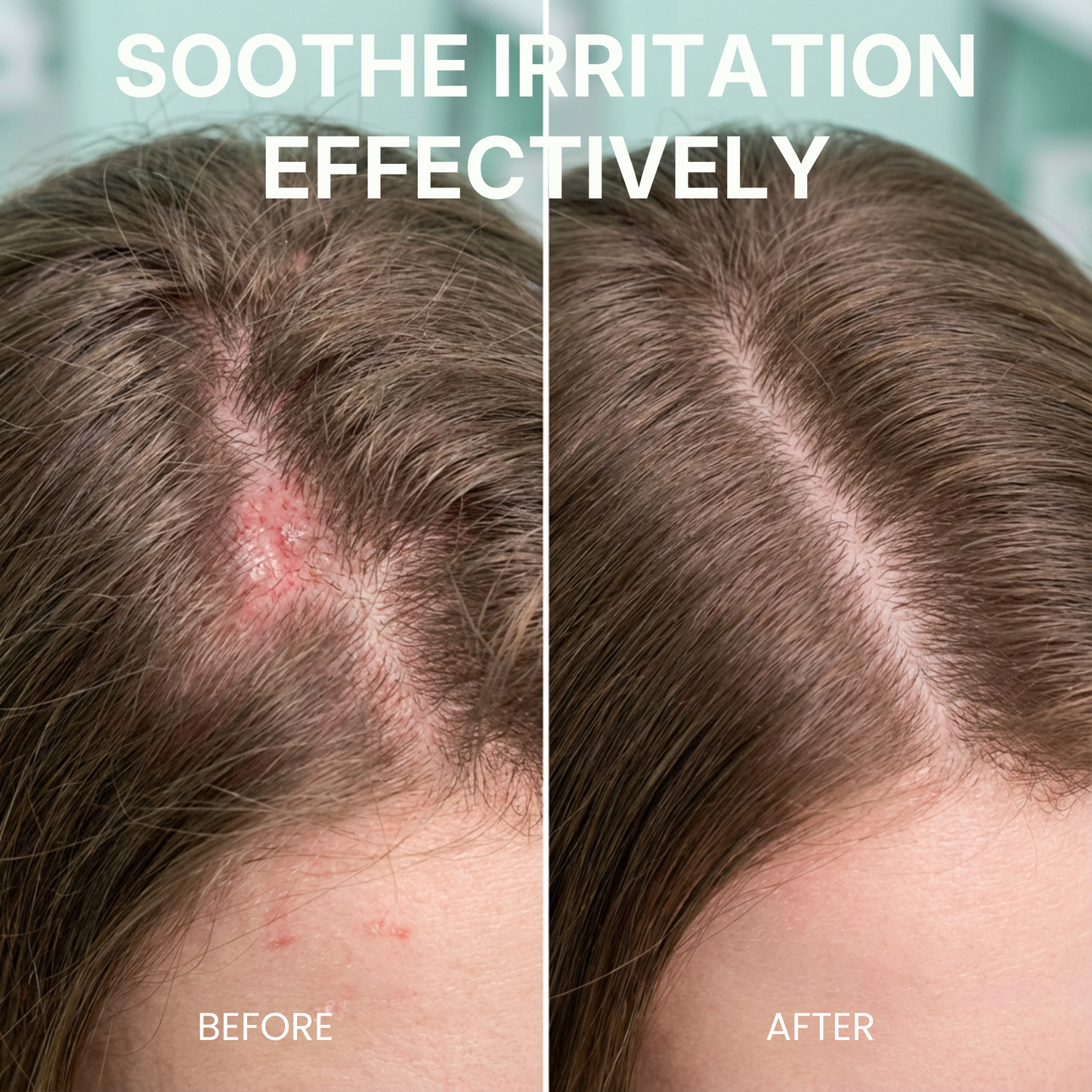 Pre-Shampoo Exfoliating for Dry, Flaky Scalp