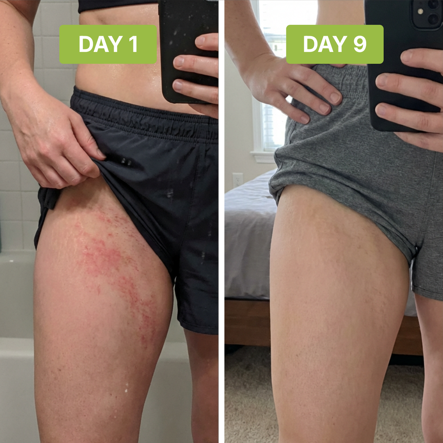 ClearSkin™ - Stops Groin Irritation and Odor at the Source.
