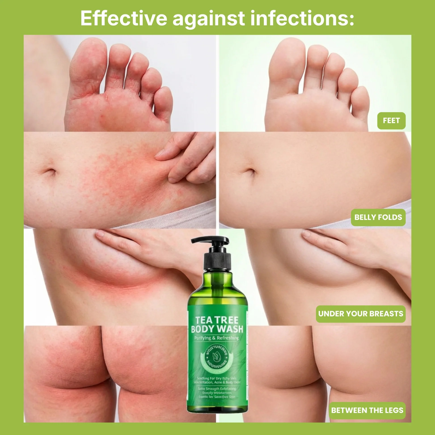 Tea Tree Antifungal Body Wash