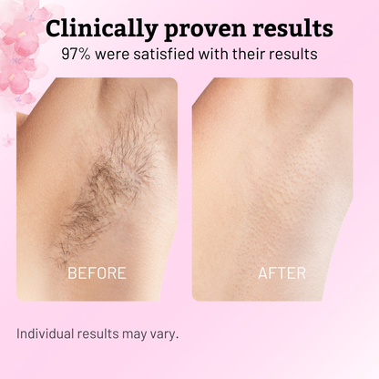 Nudae™ - Oil for Natural Permanent Hair Reduction