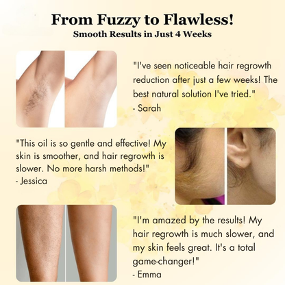 Nudae™ - Oil for Natural Permanent Hair Reduction
