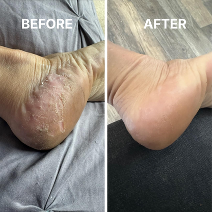 SkinFix - Target cracked, rough skin fast. Wake up to softer skin.
