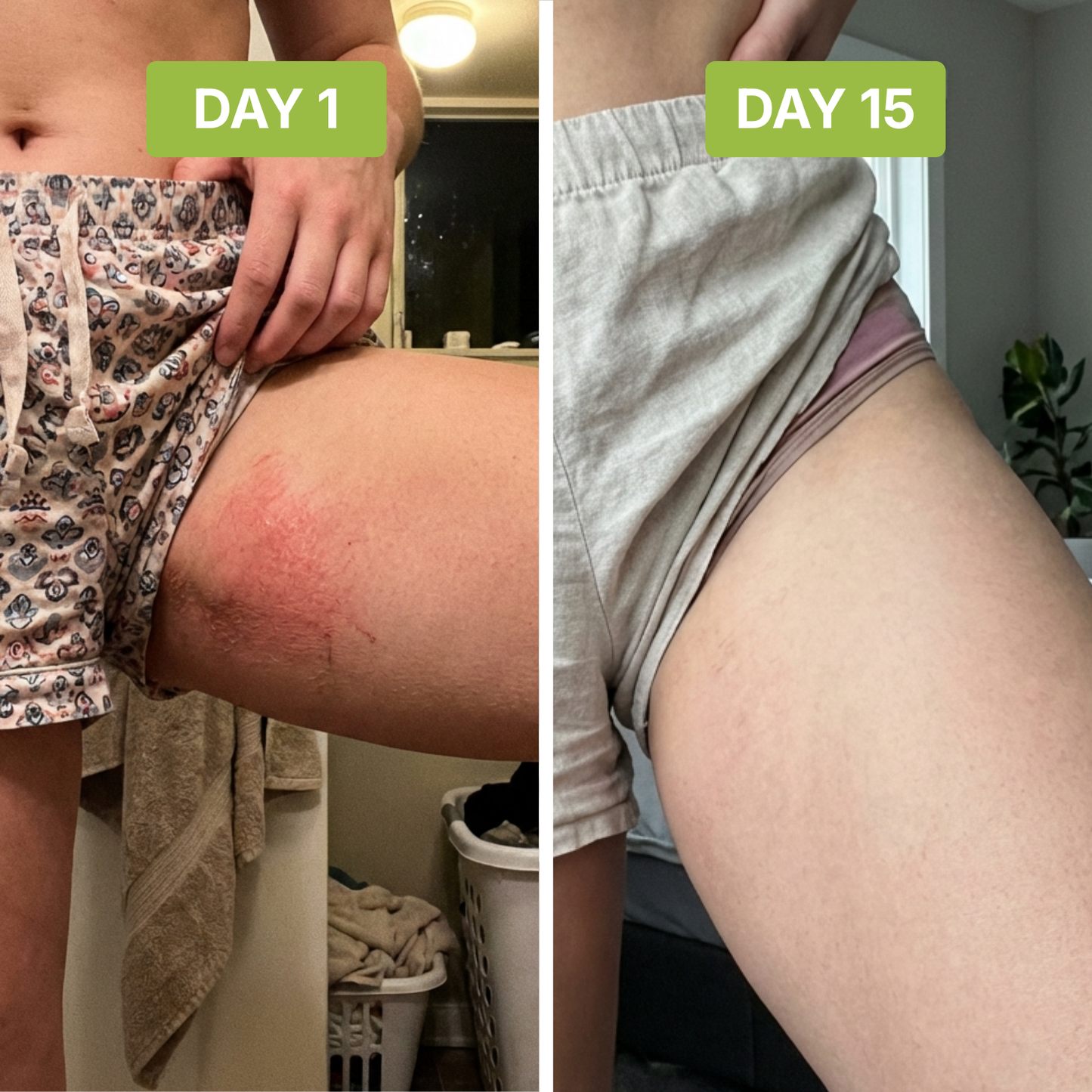 ClearSkin™ - Stops Groin Irritation and Odor at the Source.