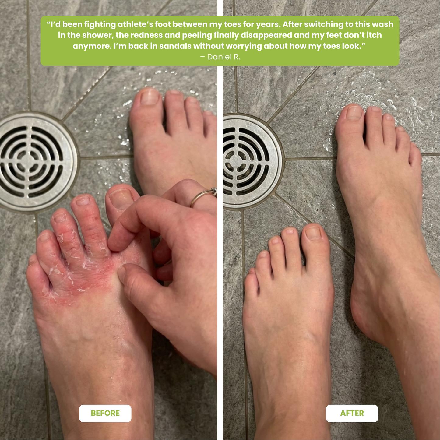 Tea Tree Antifungal Body Wash