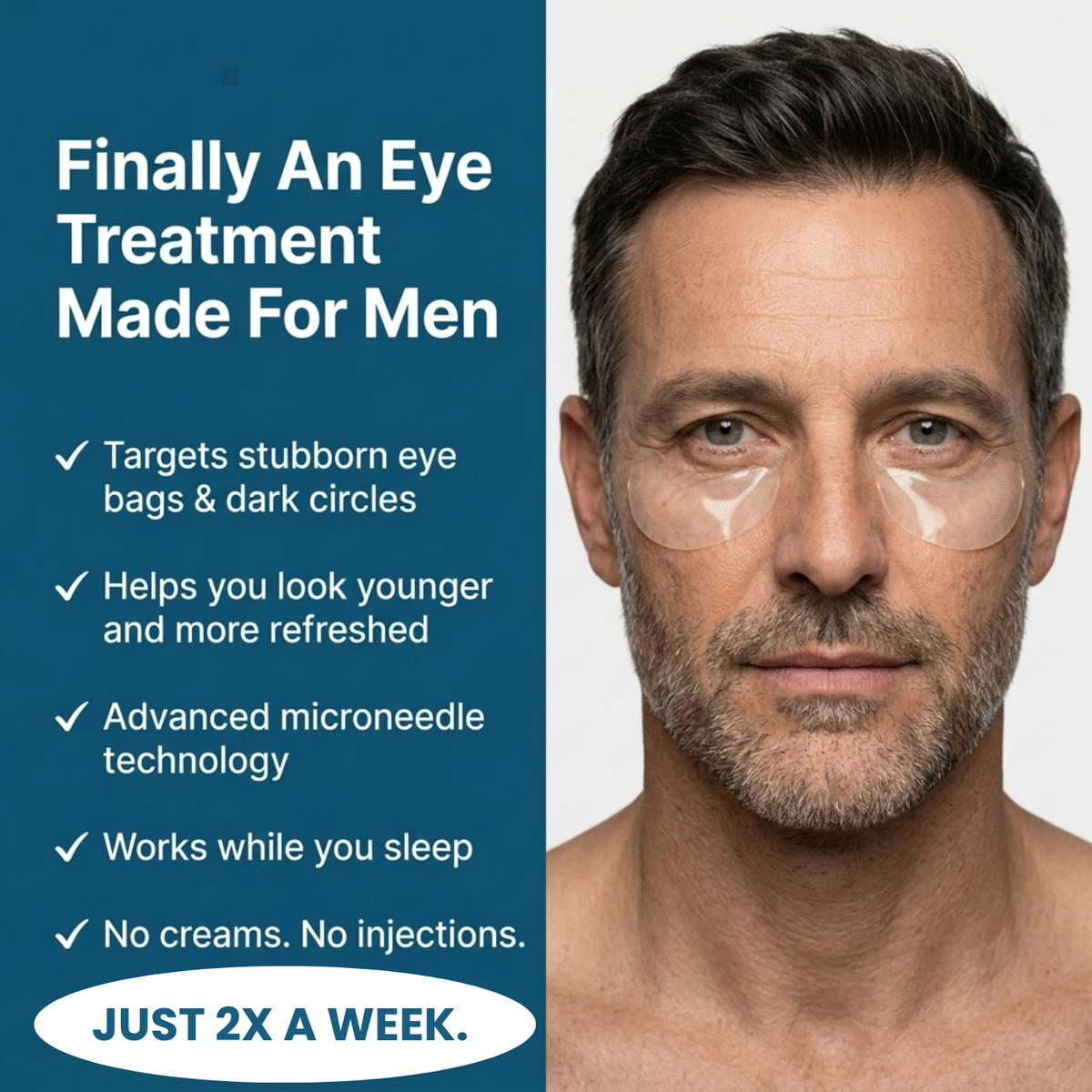 SYLK Microneedle Patches
