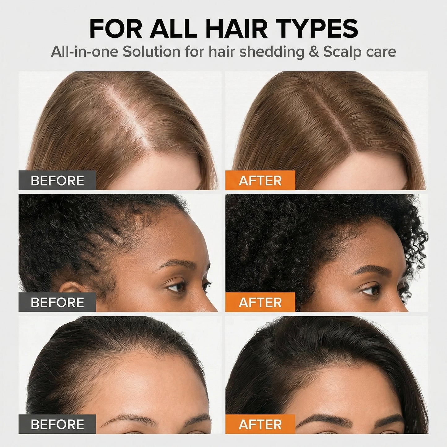 GROW:TURN - Hair Growth Serum