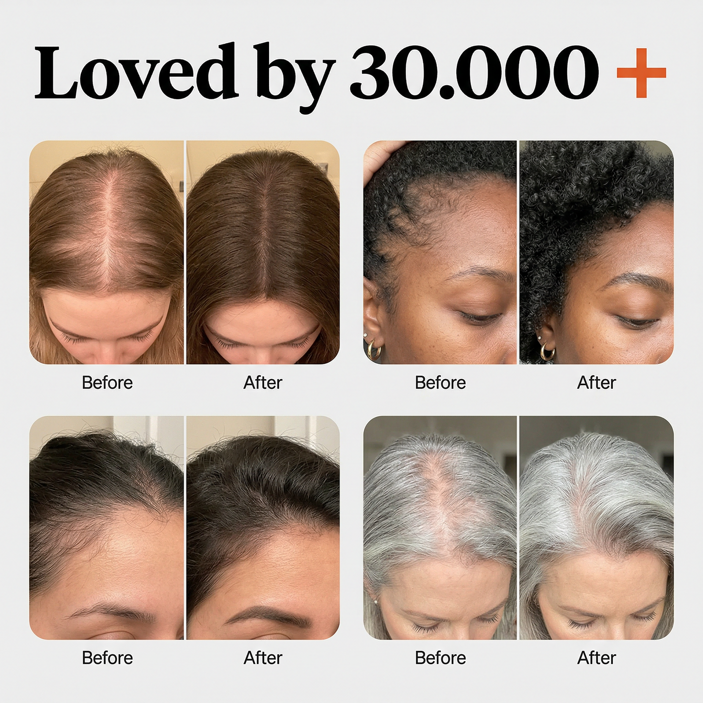 GROW:TURN - Hair Growth Serum