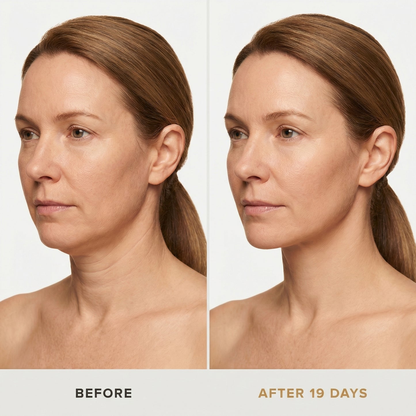 JAWLIFT® Mask — Sculpt the jawline in 30 min