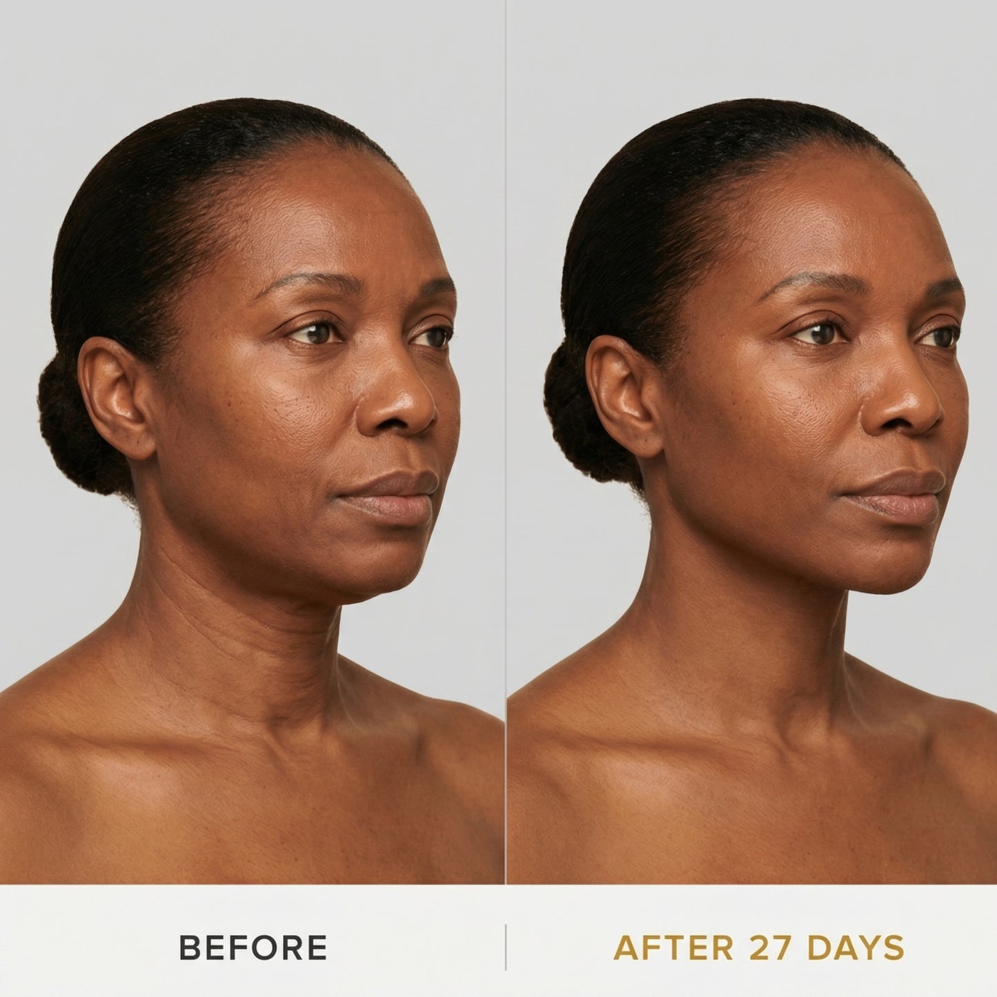 JAWLIFT® Mask — Sculpt the jawline in 30 min