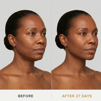 JAWLIFT® Mask — Sculpt the jawline in 30 min